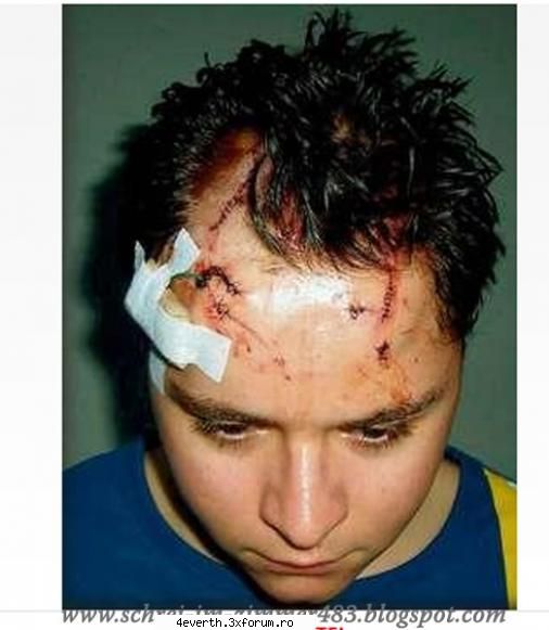 gusti spital [img]