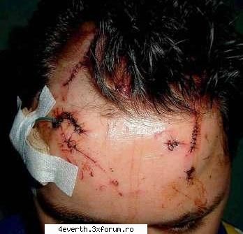 gusti spital [img]