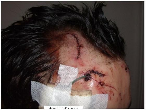 gusti spital [img]